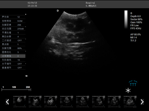 S7推車式獸用彩超機-寵物b超機掃描圖